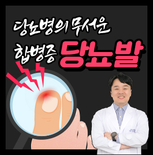 당뇨병의 무서운 합병증-당뇨발