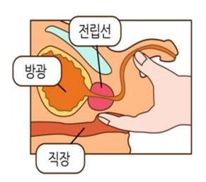 신체검사